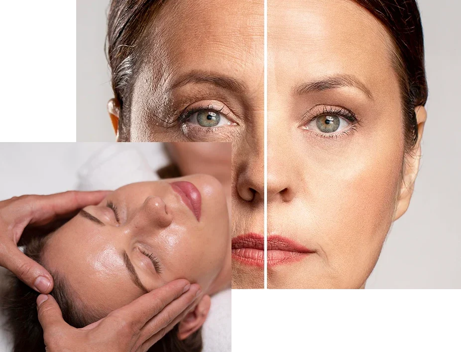 Acido-Hialuronato Acido-Hialuronato