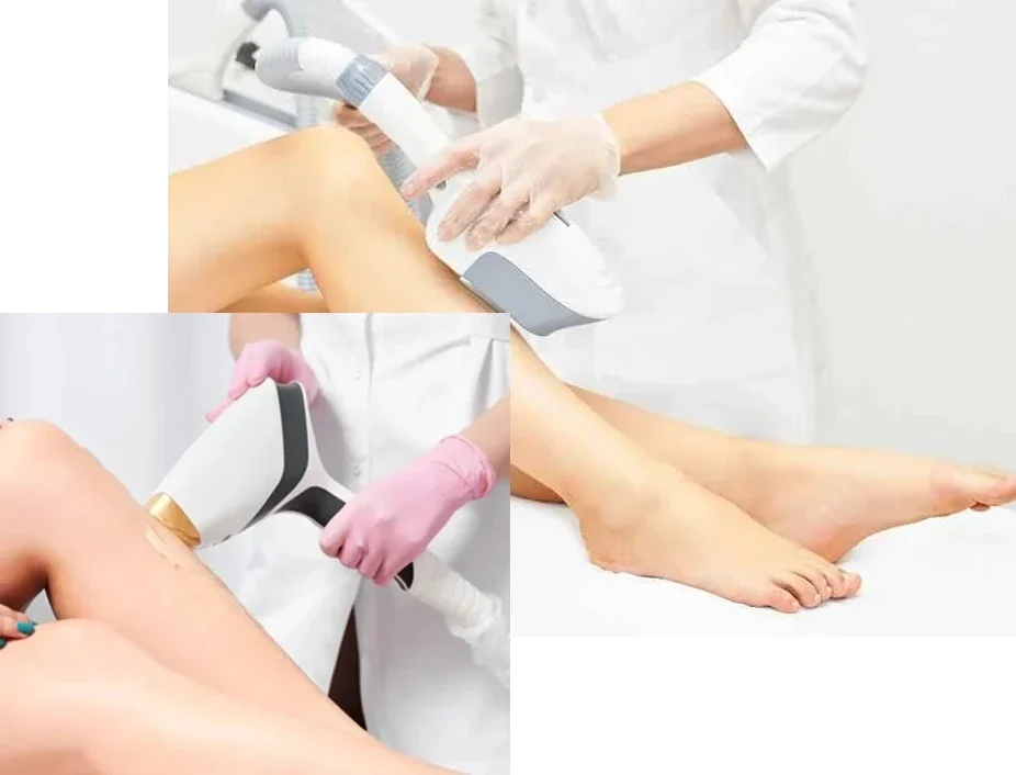 Depilacion-Laser-Triodo Depilacion-Laser-Triodo