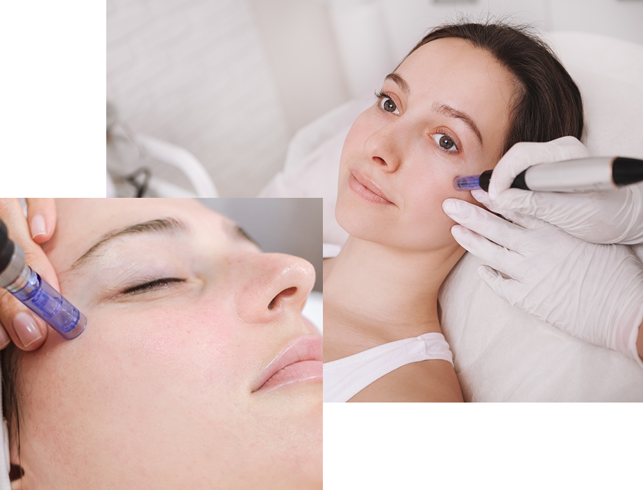 Dermapen Dermapen
