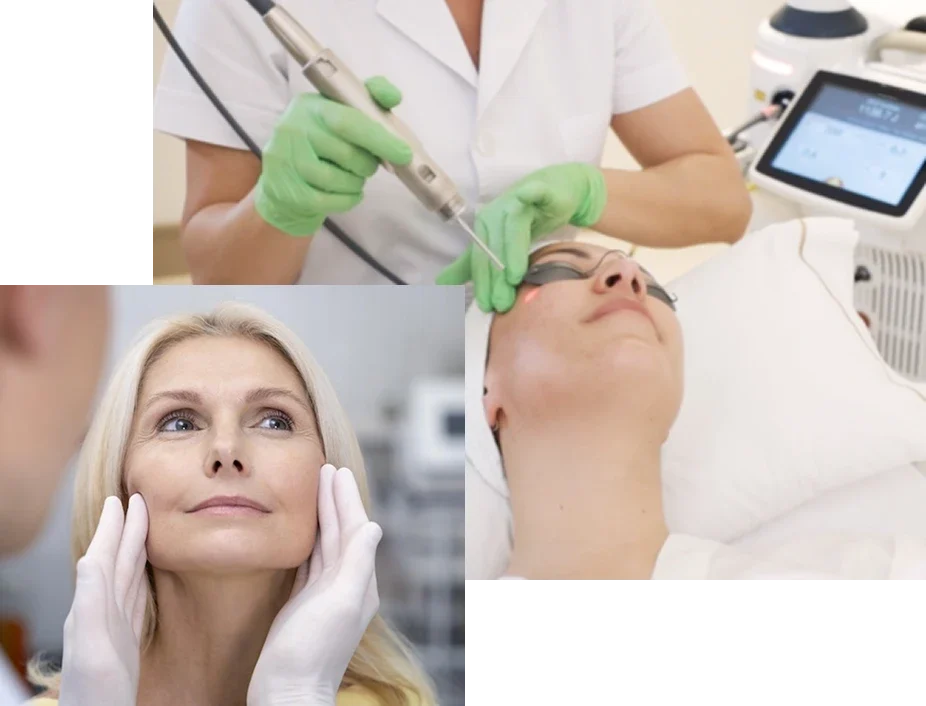 Efecto-Lifting Efecto-Lifting