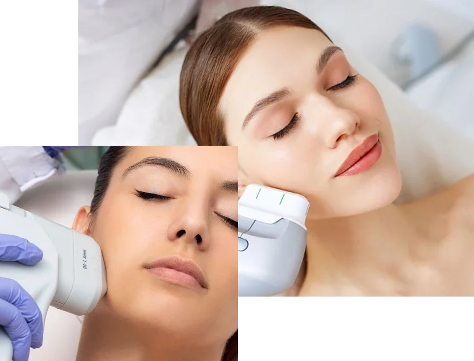 HIFU-Corporal-1 HIFU-Corporal-1