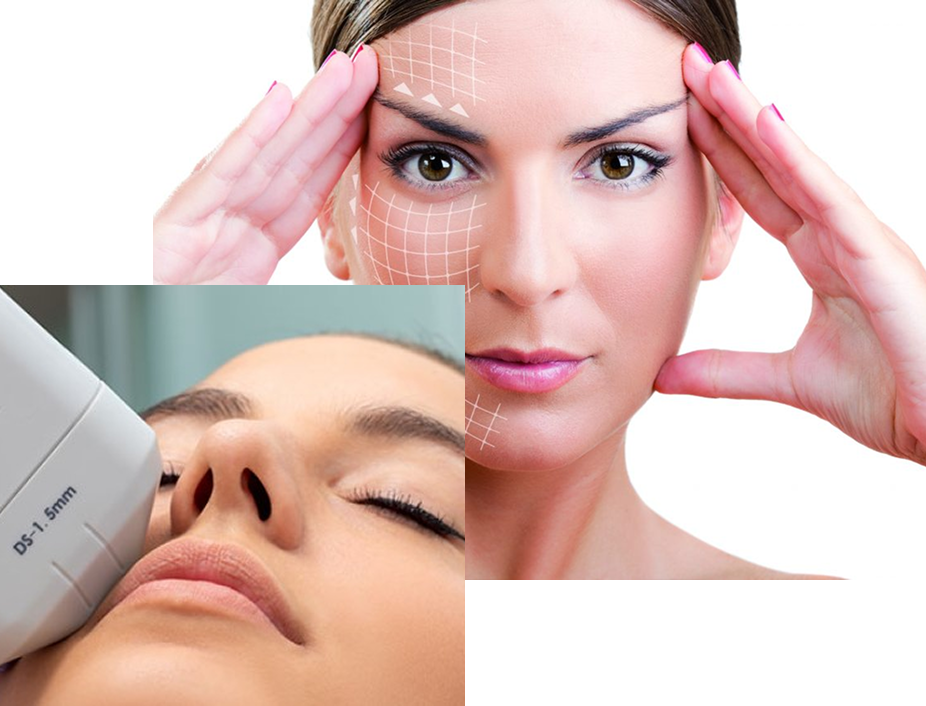 HIFU Facial HIFU Facial