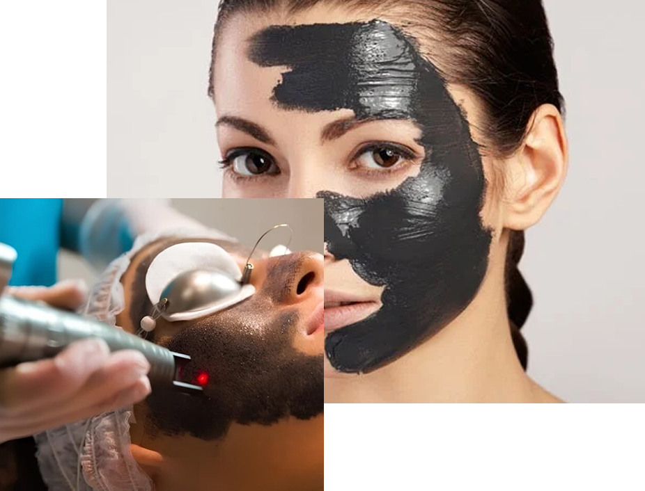 Hollywood Peel Hollywood Peel