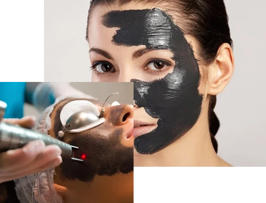 Hollywood-Peel Hollywood-Peel