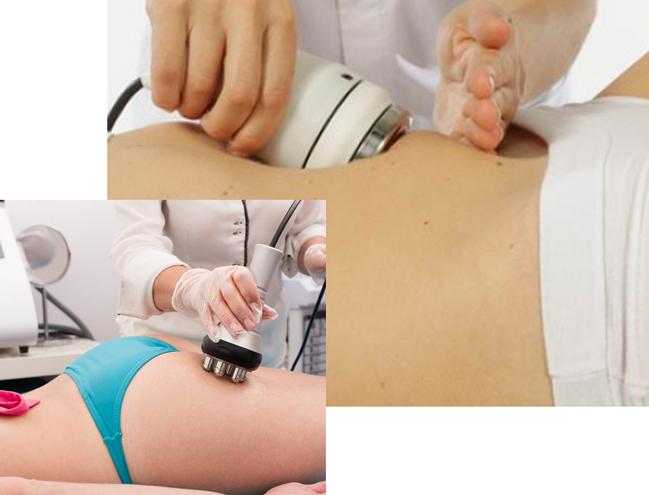 Lipoenzimas +Cavitación + Carboxiterapia Lipoenzimas +Cavitación + Carboxiterapia