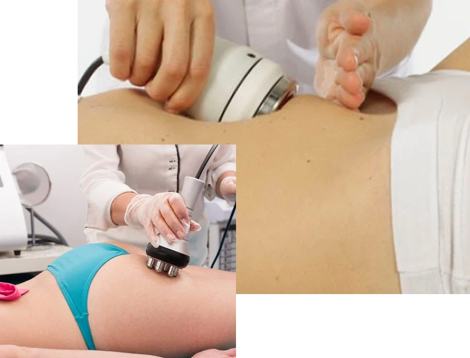 Lipoenzimas-Cavitacion-Carboxiterapia Lipoenzimas-Cavitacion-Carboxiterapia