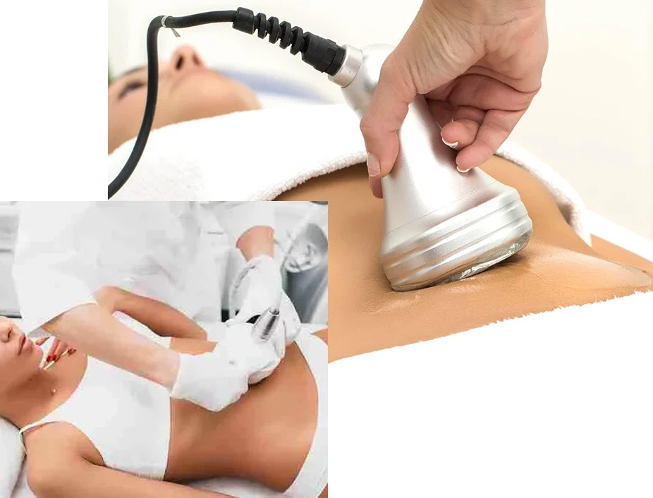 Lipoescultura-Ultrasonica Lipoescultura-Ultrasonica